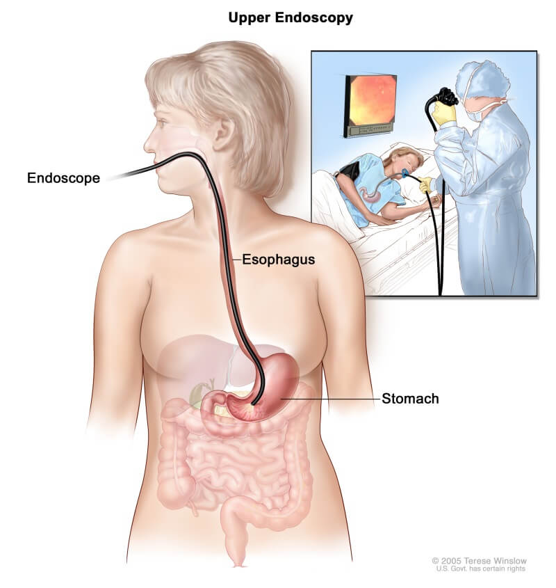 endoscopy