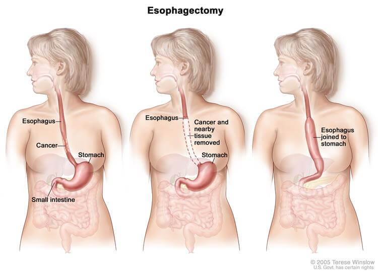 endoscopy