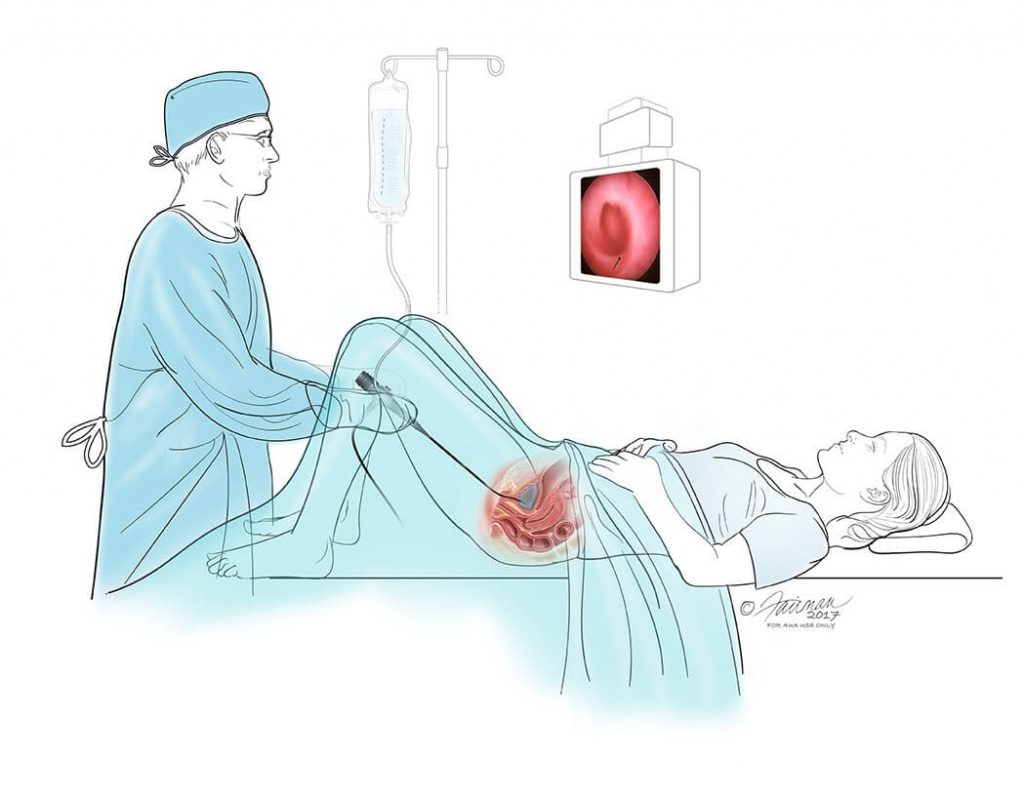 Cystoscopes Test