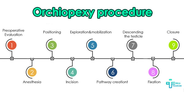 Orchiopexy procedure
