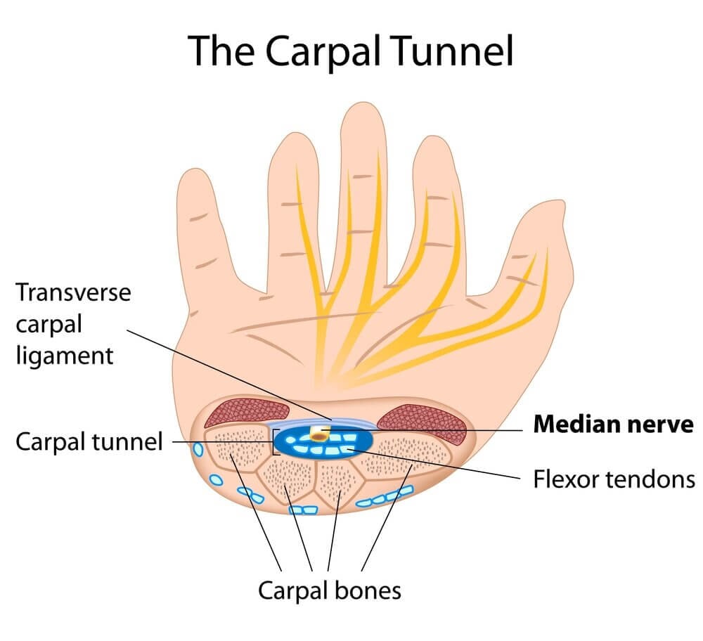 carpaltunnelsurgerybothhands