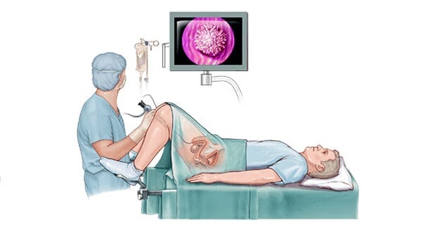 Cystoscopy