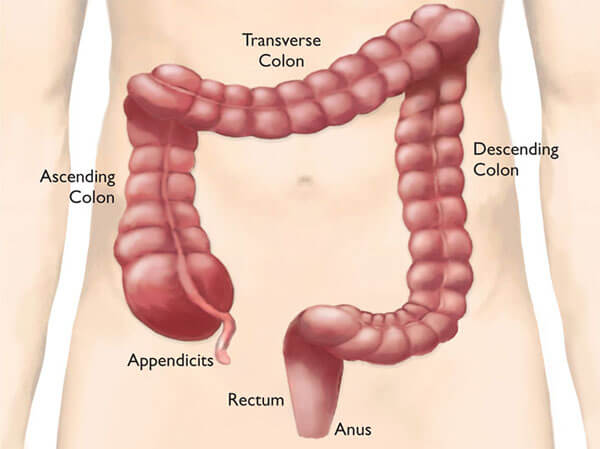 colorectal-diagram-2