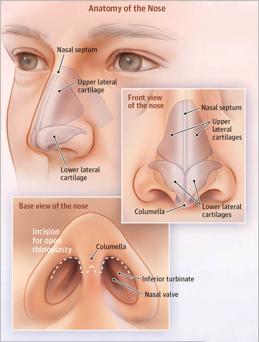 Rhinoplasty nose job in Iran