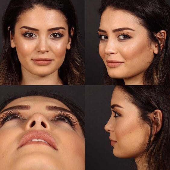 Rhinoplasty nose job in Iran