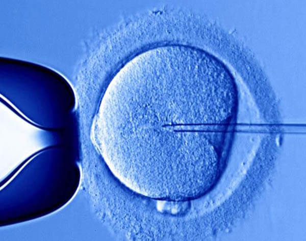 IVF in Iran