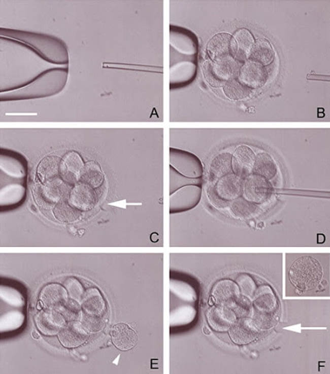 IVF in Iran