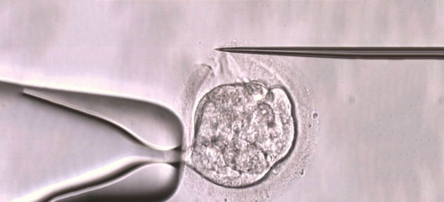 infertility treatment in Iran