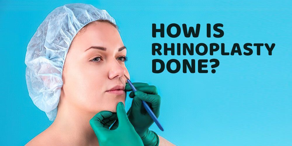How is rhinoplasty done