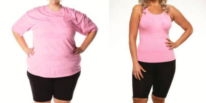 story-of-aino-gastric-bypass-surgery-case-study-health-travel-guide-800x400