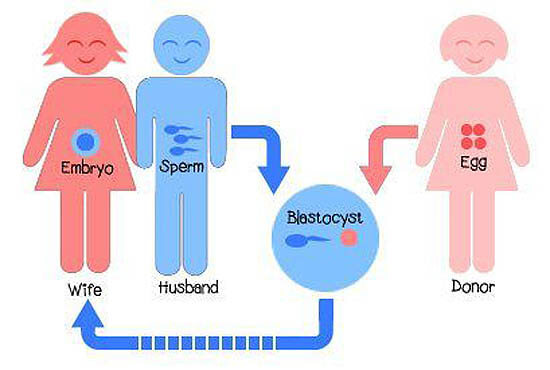 Egg donation in Iran