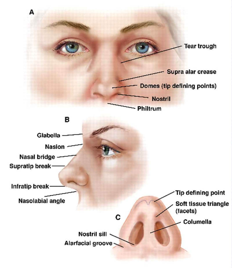 Rhinoplasty nose job in Iran