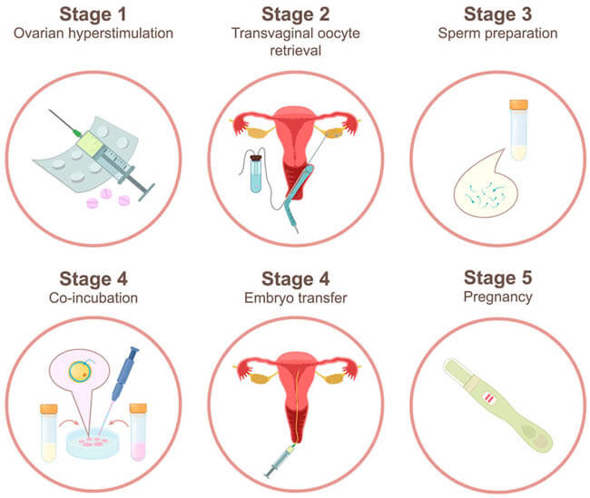 Egg donation in Iran