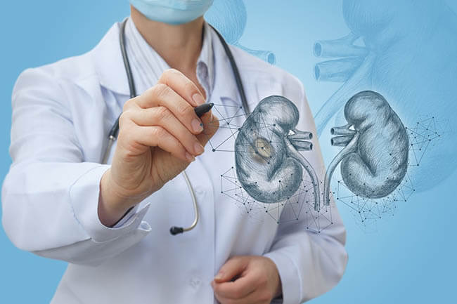 success rate of kidney transplant