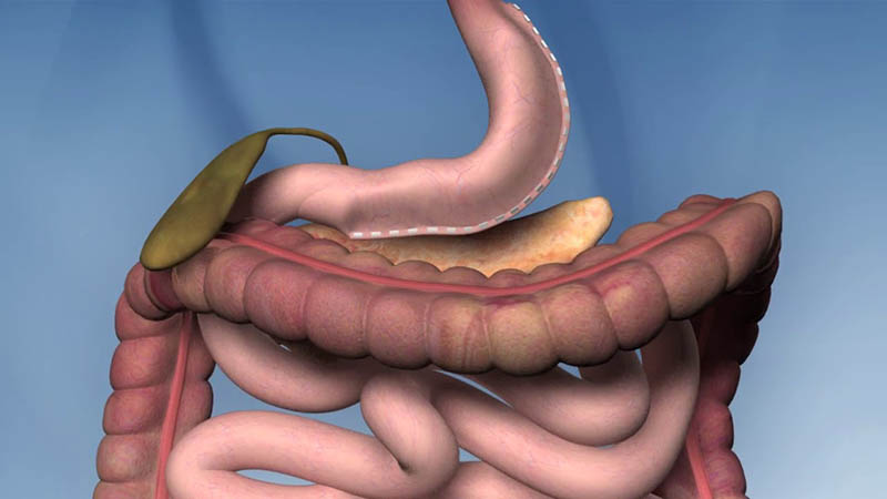 When Can I Drink Alcohol After Gastric Sleeve Surgery 