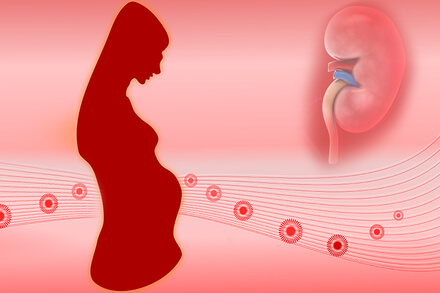 Does kidney transplant affect the pregnancy