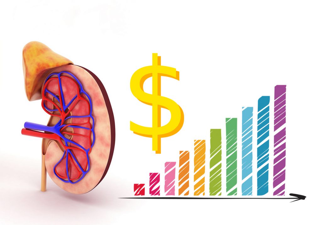 Factors Affecting the Cost of Kidney Transplantation