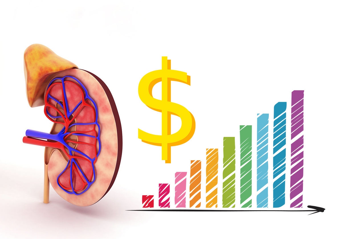 factors-affecting-the-cost-of-kidney-transplantation