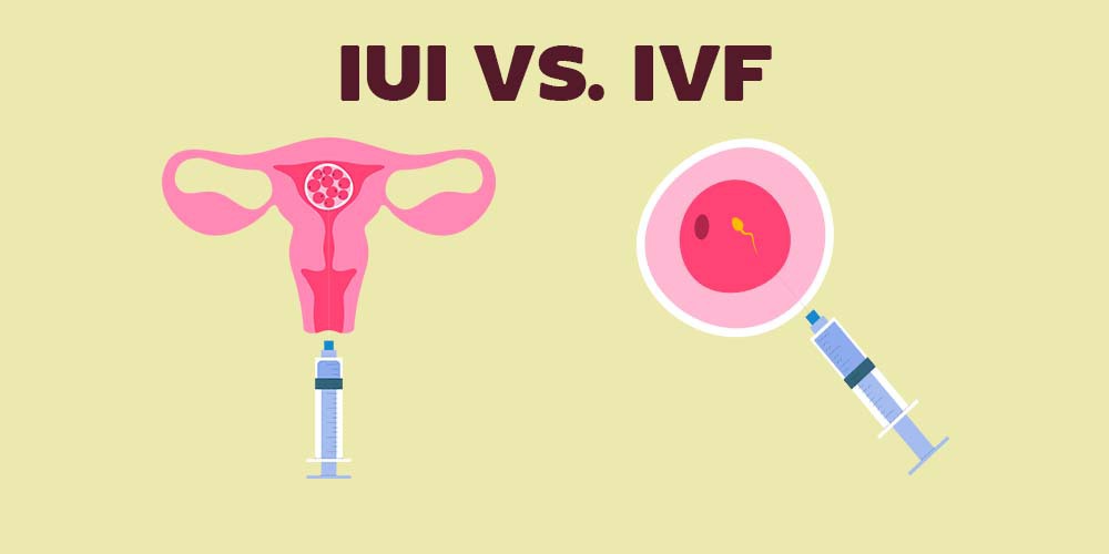 IUI VS IVF