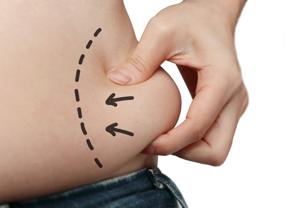 What are the risks and possible complications of Mesolipolysis