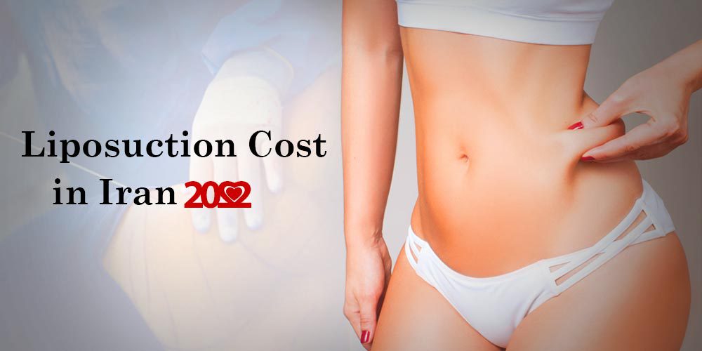 Liposuction Cost in Iran 2022
