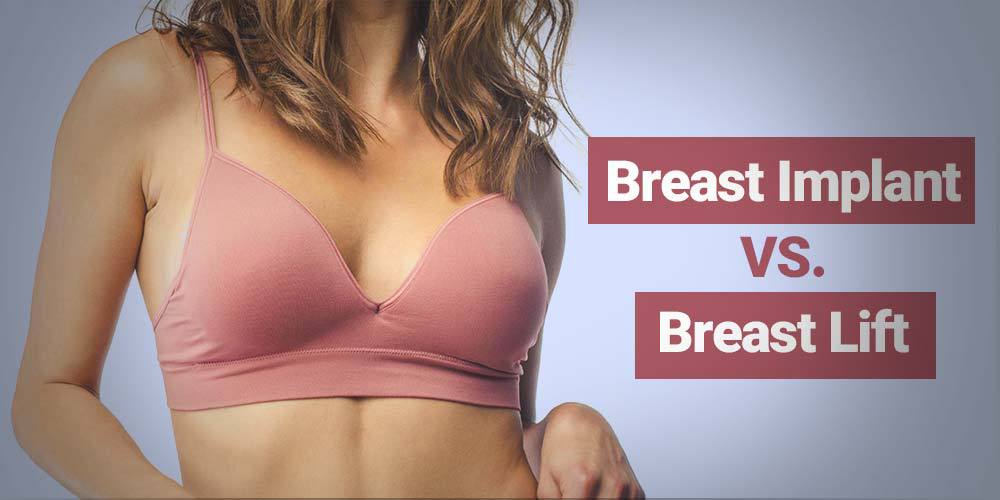 Breast Implant VS. Breast Lift