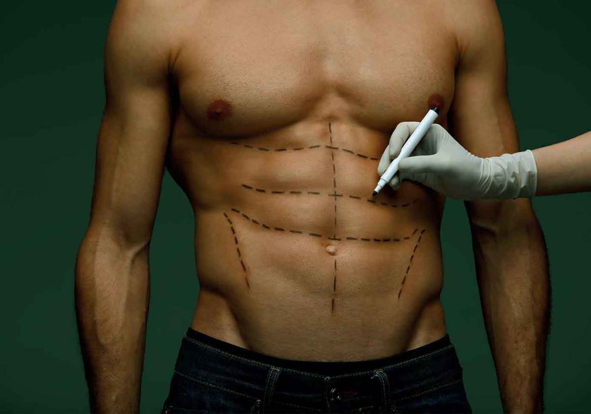 six pack abs by liposuction