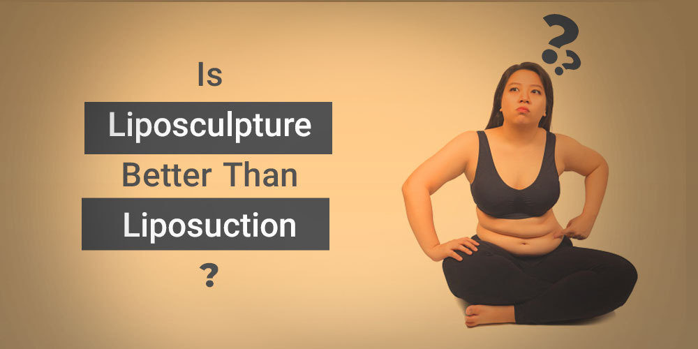 Is Liposculpture Better Than Liposuction?