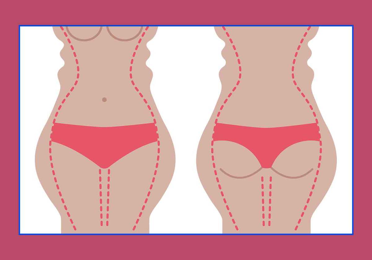 the difference of liposuction and liposculpture