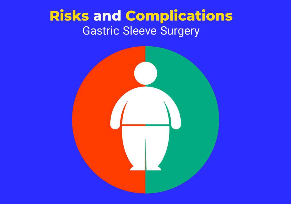 Risks and Complications of Gastric sleeve surgery