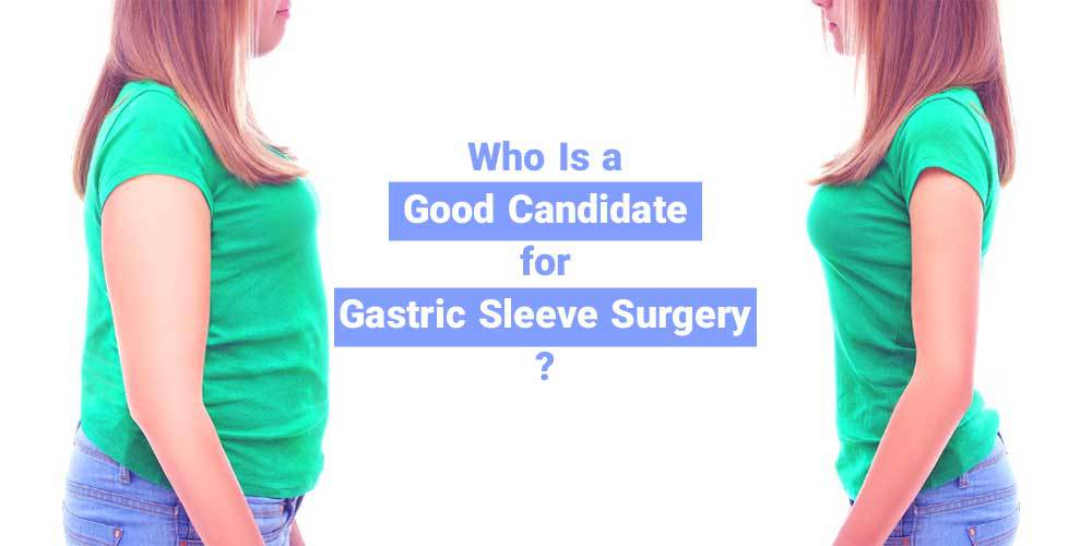 Who Is a Good Candidate for Gastric Sleeve Surgery?