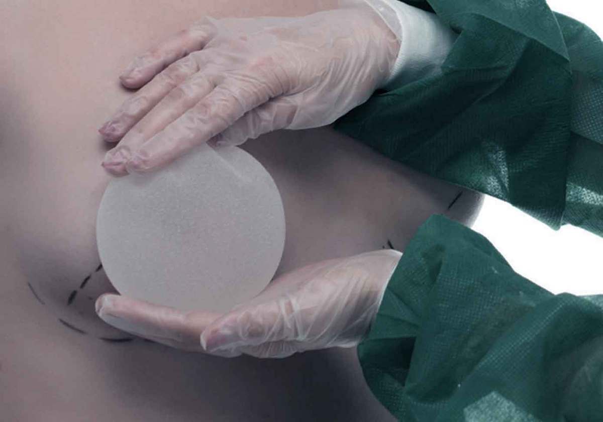 Risks of Breast Implants