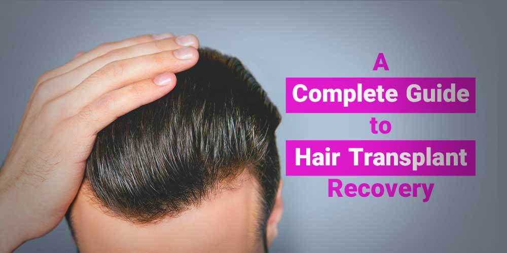 A Complete Guide to Hair Transplant Recovery
