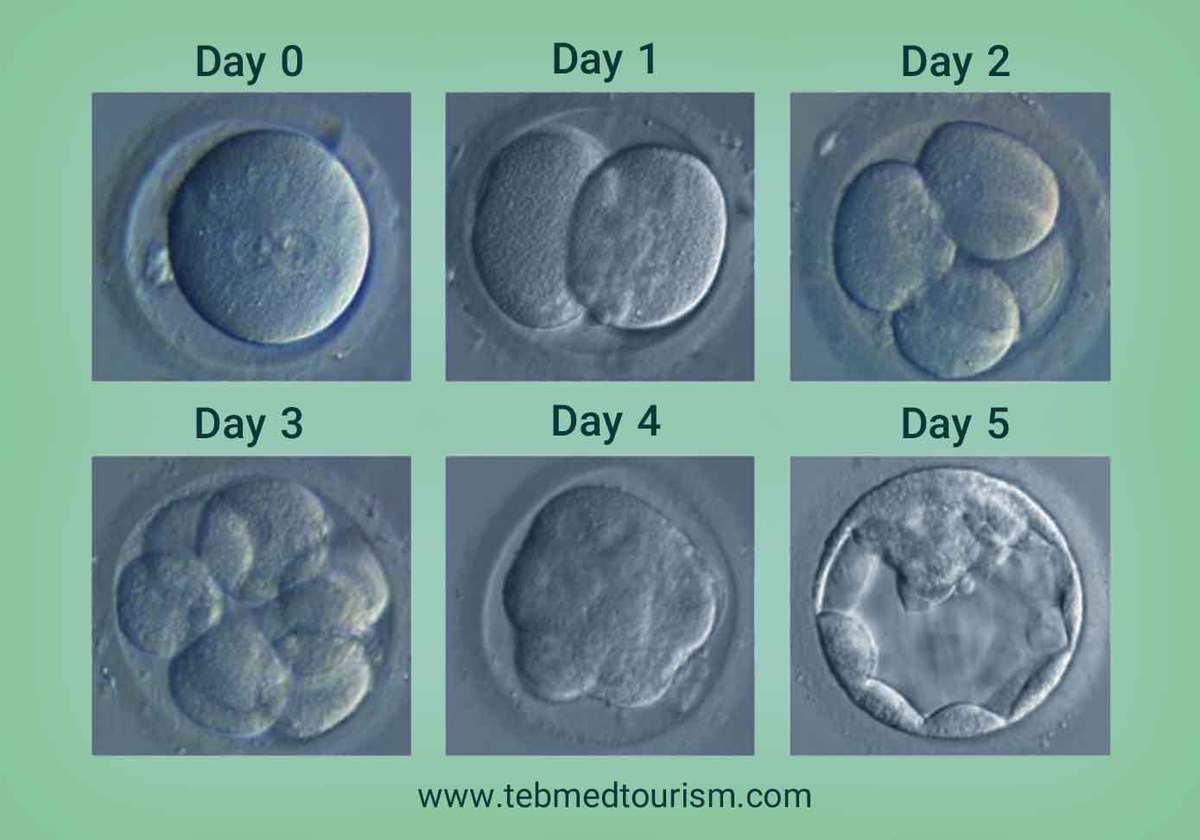 how long does ivf take