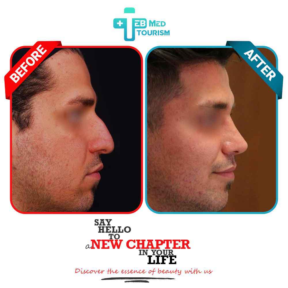 Clients' Before and after photos