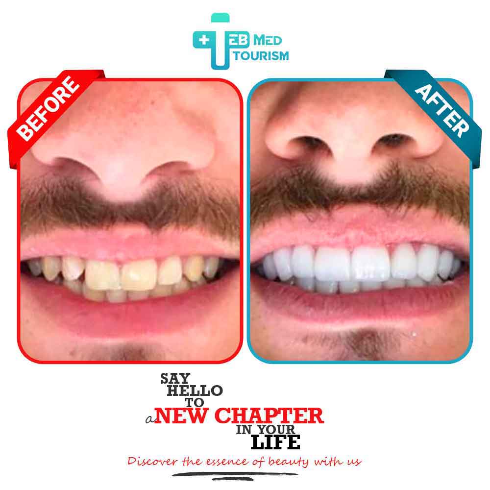 Clients' Before and after photos