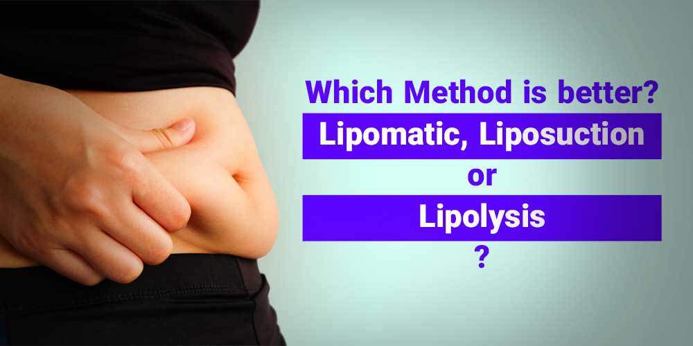 Which Method is better? Lipomatic, Liposuction, or Lipolysis?