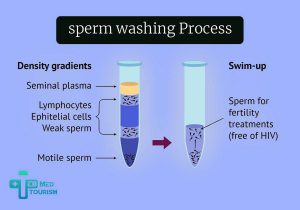Can sperm washing be effective