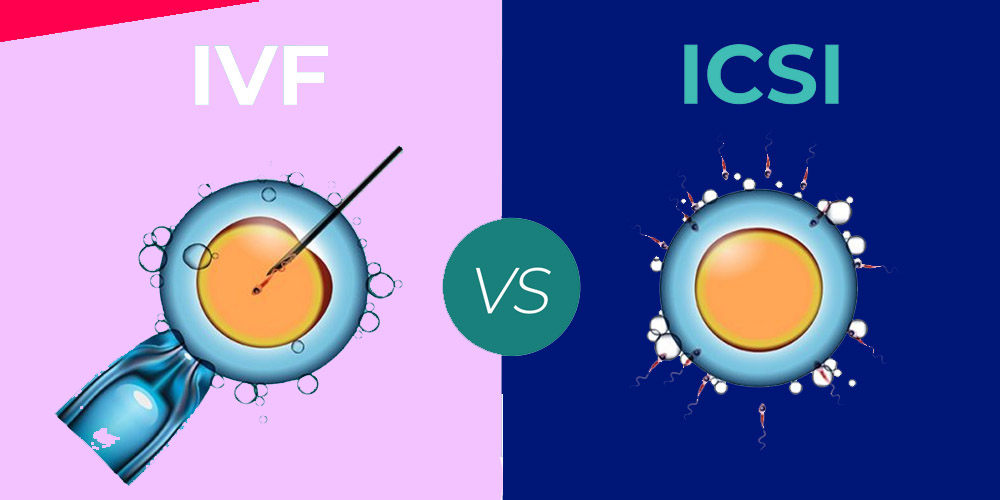differences between IVF and ICSI