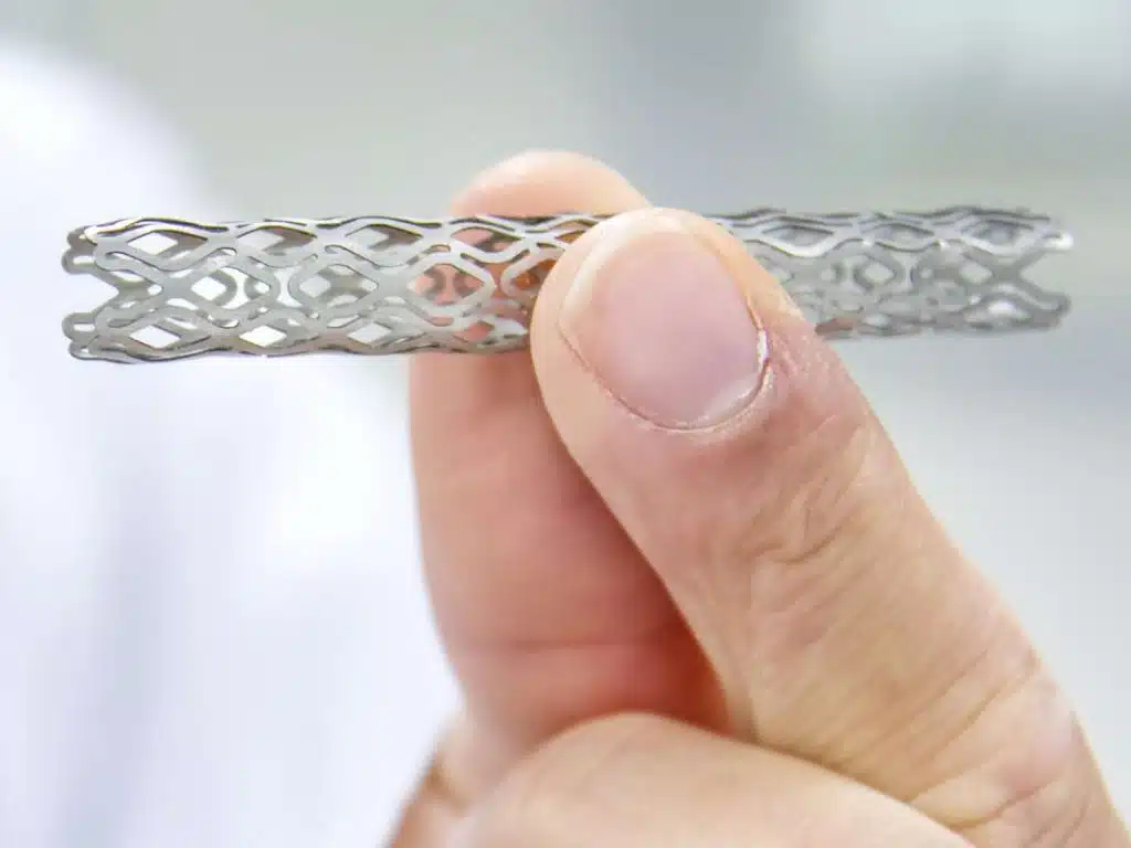 Angioplasty in Iran