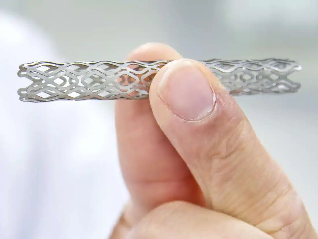 Angioplasty in Iran
