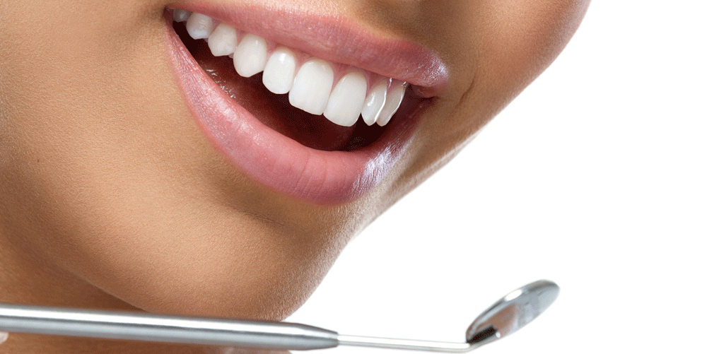 How to Get a Hollywood Smile; Whitening or Veneers?