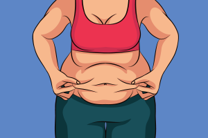 Sleeve weight loss surgery in Iran