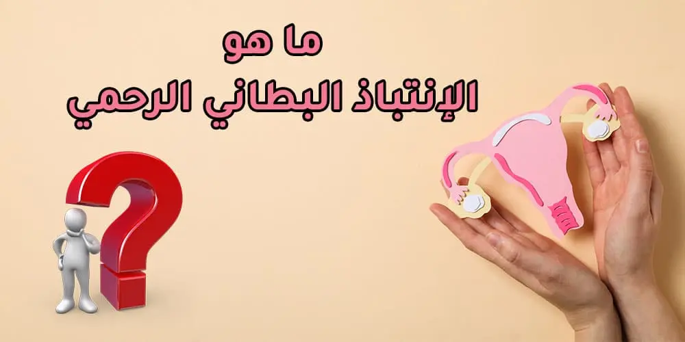 كيف يؤثر مرض الانتباذ البطاني الرحمي على صحة المرأة؟
