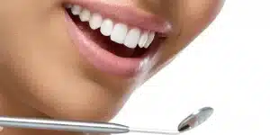 5 نوع روکش دندان مورد استفاده در طرح لبخند هالیوودی