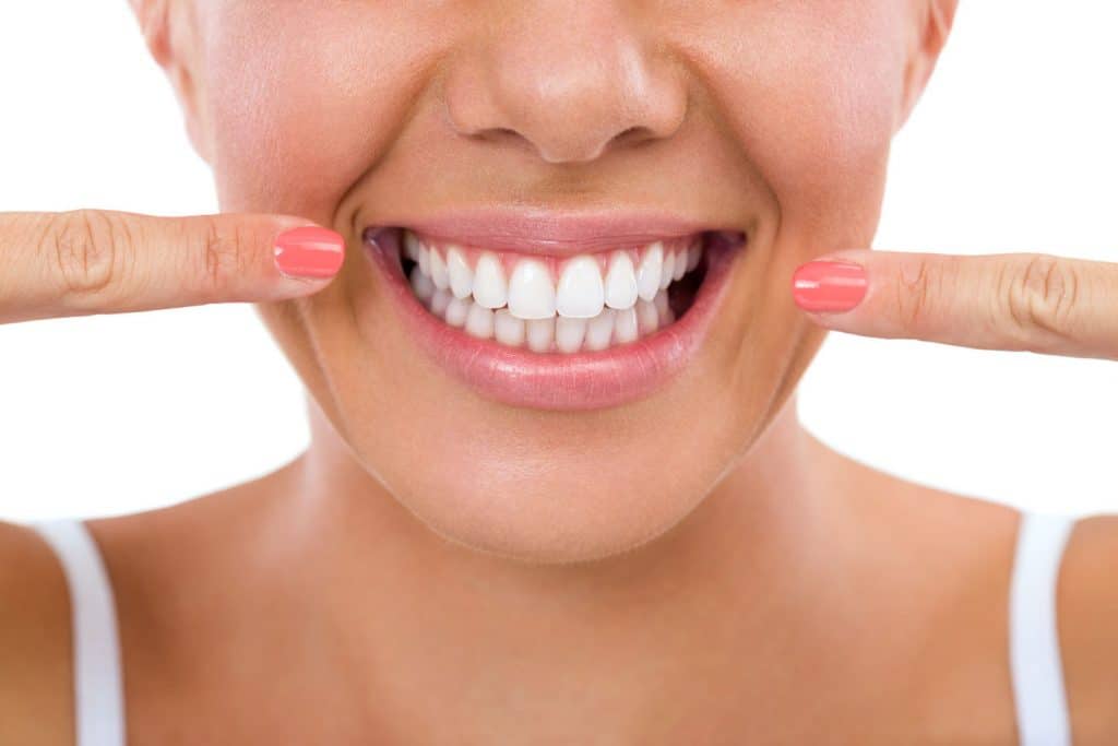 Dental Laminates (Porcelain Veneer) (Hollywood Smile) in Iran