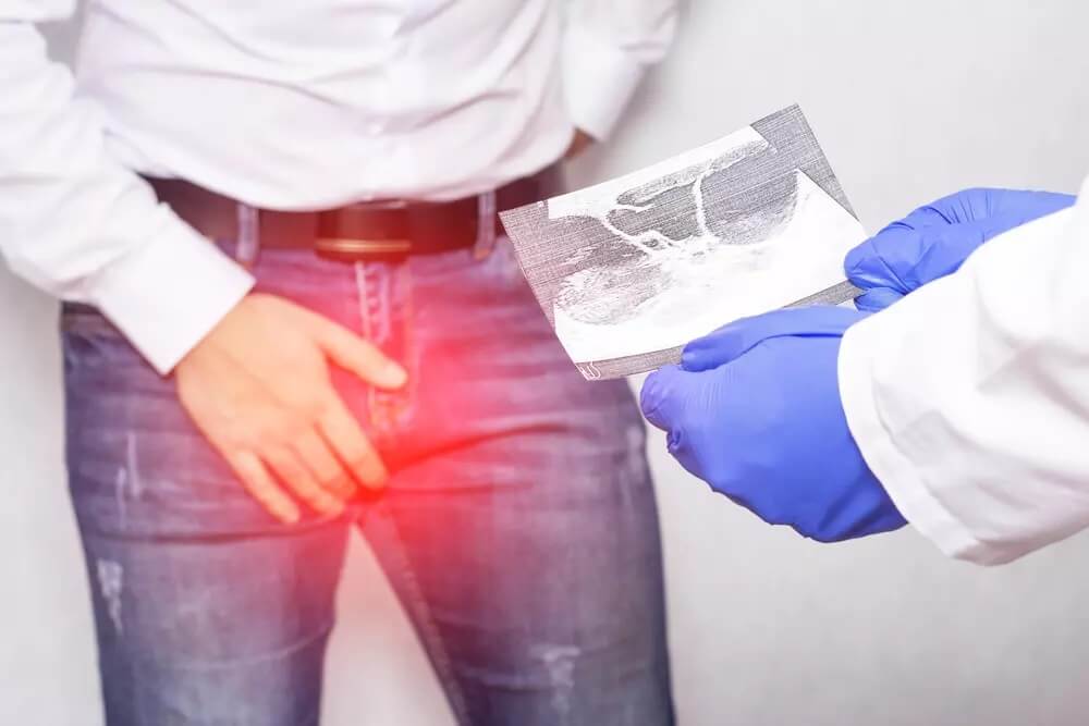 Everything you need to know about varicocele and varicocelectomy in Iran