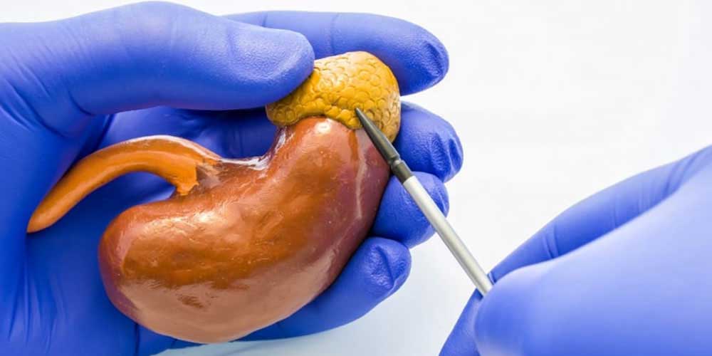 Does obesity affect the success rate of kidney transplant?