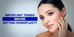 Important Things Before Getting Rhinoplasty