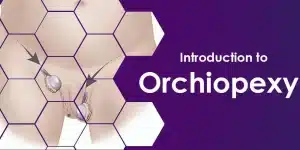 Orchiopexy